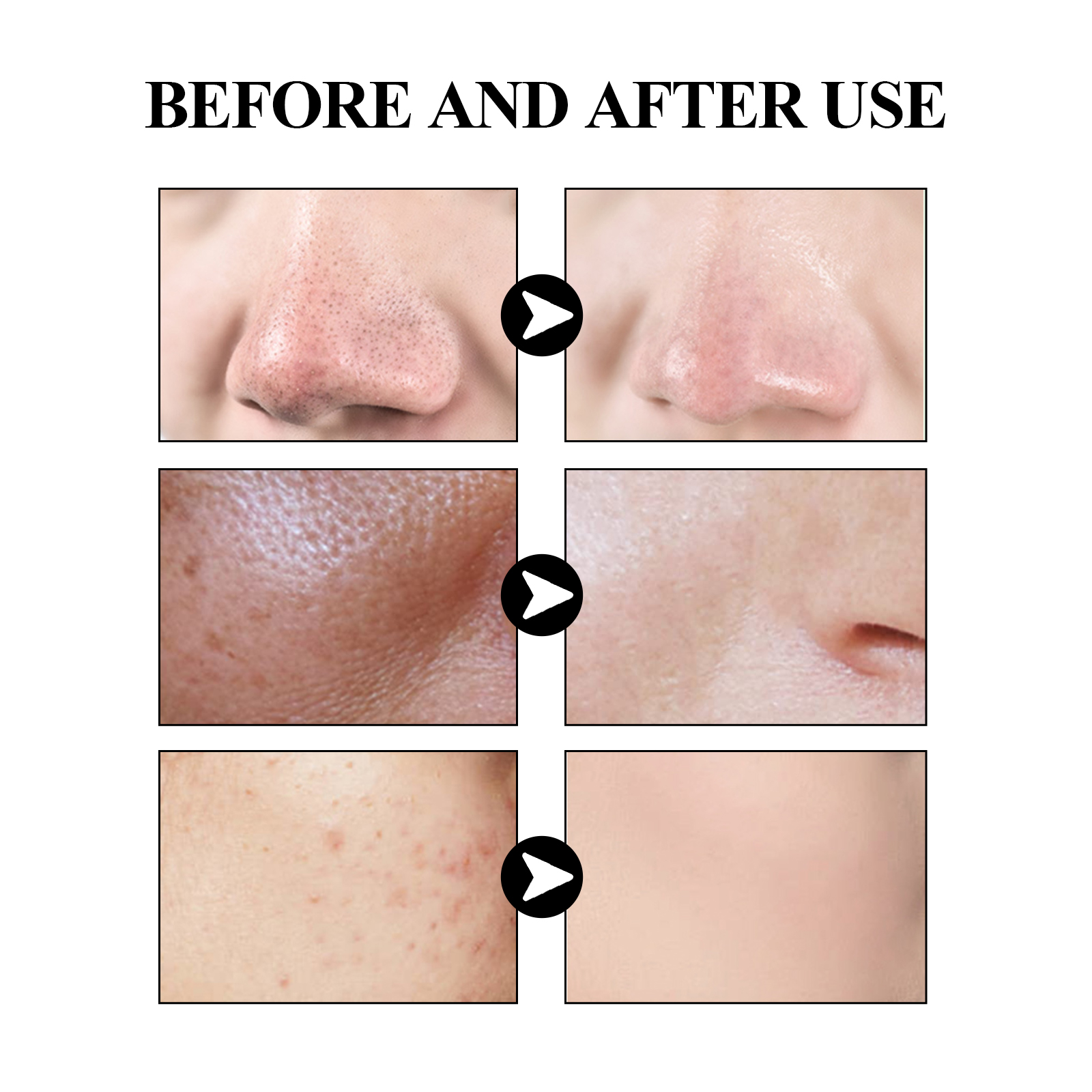 40g Activated carbon facial ma - đánh giá và giá Mud Mask Kaolin